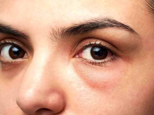 راز چشم های شاداب و بدون پف در انجام این کار هاست