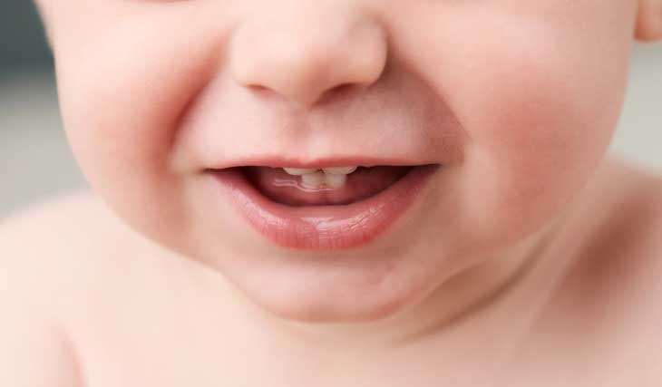 دانستنی هایی درباره دندان های نیش کودک +اینفوگرافی