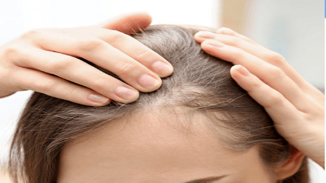 این عادت‌های اشتباه باعث بیشتر شدن ریزش مو در زنان می‌شود
