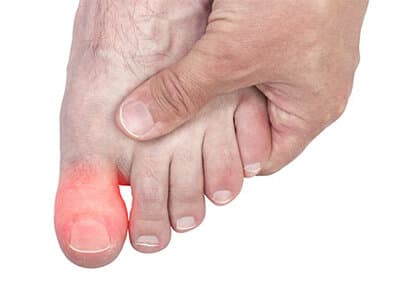 علت التهاب در انگشتان پا چیست؟