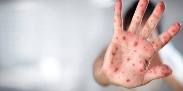 آغاز توزیع واکسن ایرانی آنفلوانزا