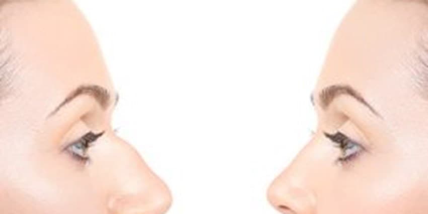 فرم دهی بینی تنها در 10 دقیقه!