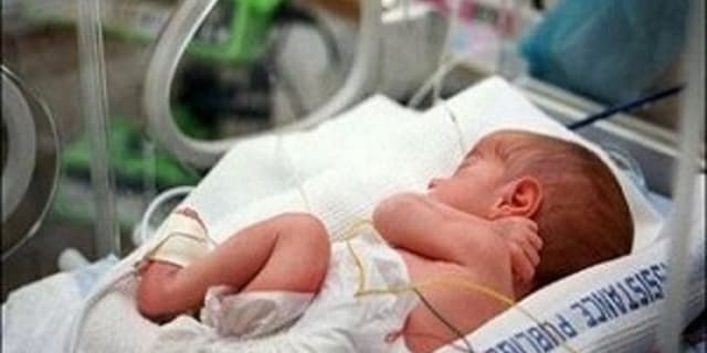 نجات یک قُل از دوقُلوهای تک جفت عارضه دار