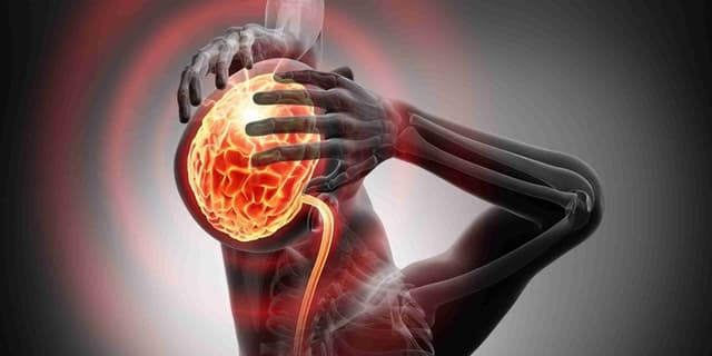 دلایل افزایش فشار درون جمجمه‌ای