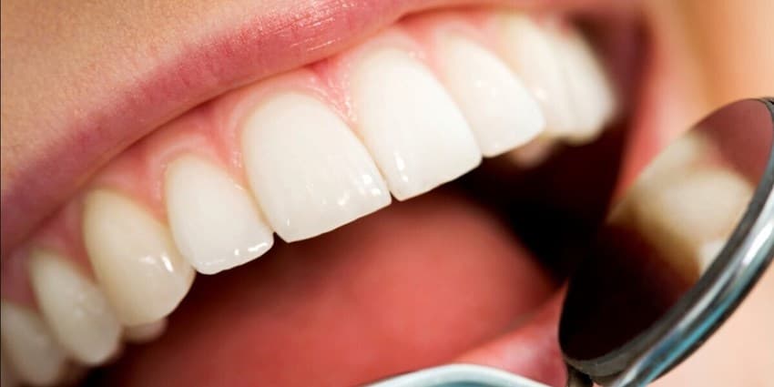 علت عفونت لثه چیست؟