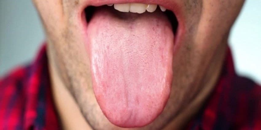 زبان درباره سلامتی چه می‌گوید؟