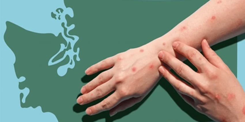 بررسی پرونده یک ویروس پر سر و صدا