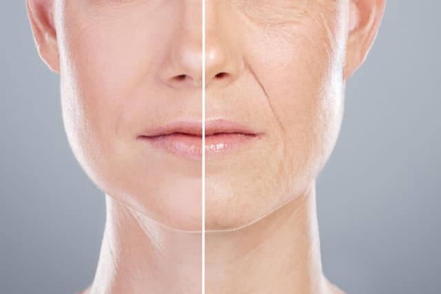 چرا متخصصان پوست به مکملهای کلاژن اعتماد ندارند؟
