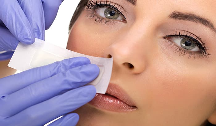 پرمویی صورت در خانمها؛ علل و روشهای مقابله