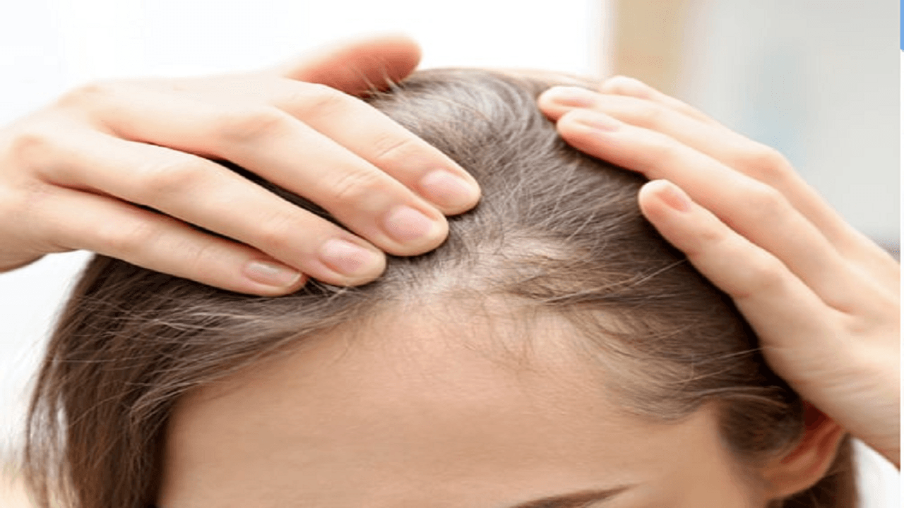 این عادتهای اشتباه باعث بیشتر شدن ریزش مو در زنان میشود