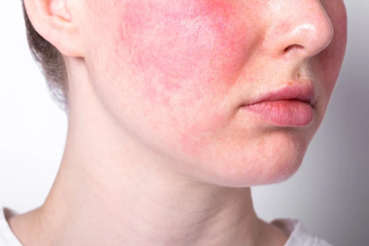 رواج سرمهای کیبیوتی و افزایش توجه به ترکیبات حساسیتزا
