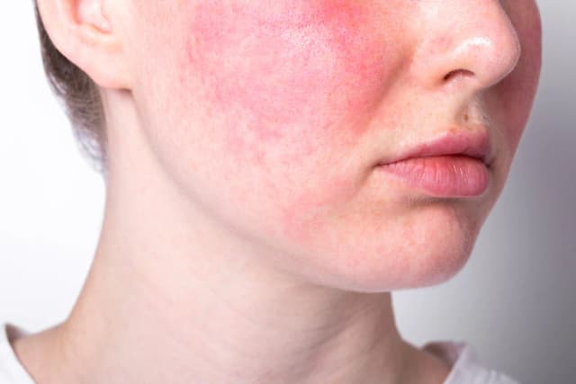 رواج سرمهای کیبیوتی و افزایش توجه به ترکیبات حساسیتزا