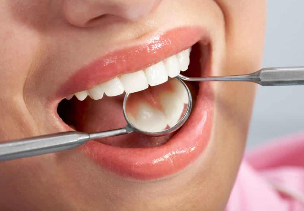 آغاز پویش ملی سلامت دهان و دندان از ۲۵ مهر