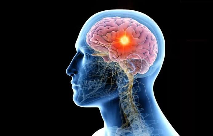 پژوهش تازه ارتباط میان محله محل زندگی و سلامت مغز را بررسی کرد