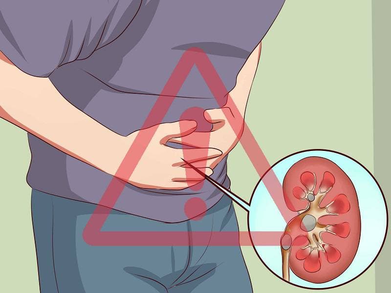 مصرف مکمل کراتین و سلامت کلیه؛ نتایج یک بررسی علمی چه میگویند؟