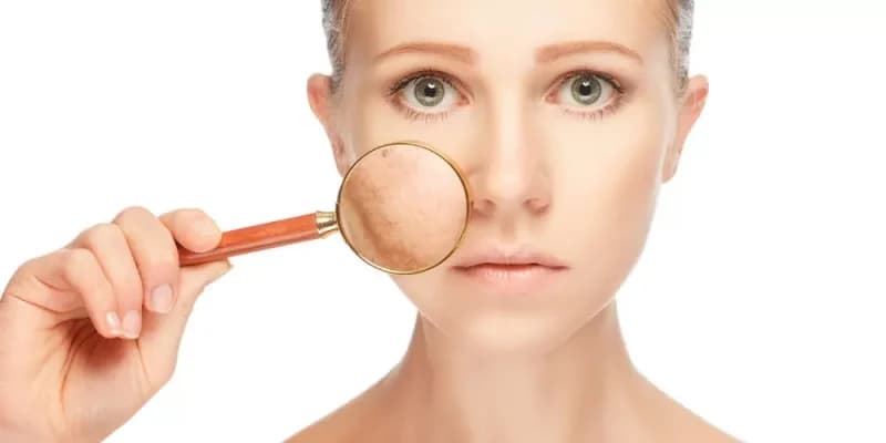 خطر استفاده نادرست از محصولات مراقبت پوست ترندشده در شبکههای اجتماعی