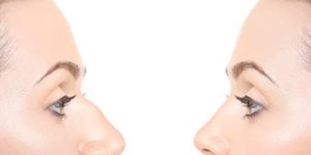 فرم دهی بینی تنها در 10 دقیقه!
