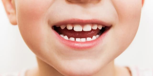 قطره آهني كه دندان کودک را سیاه نميكند، بخريم؟