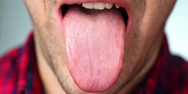 زبان درباره سلامتی چه میگوید؟